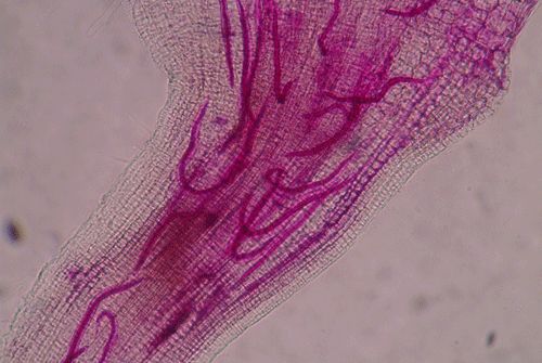 Second-stage juveniles (J2) of root-knot nematode inside of a root