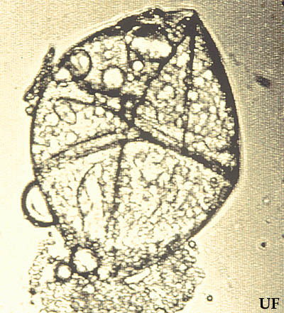 Egg of proturan from the family Eosentomidae (1200x). 