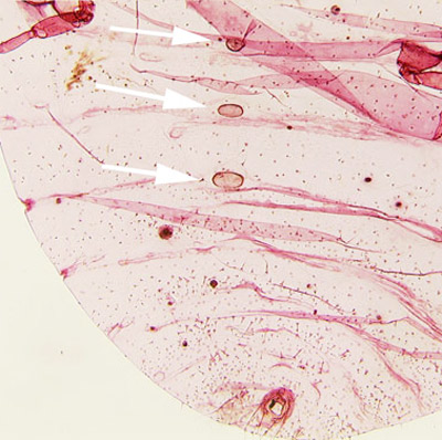 Slide mounted specimen of Hypogeococcus pungens Granara de Willink. Arrows pointing to three circuli. 
